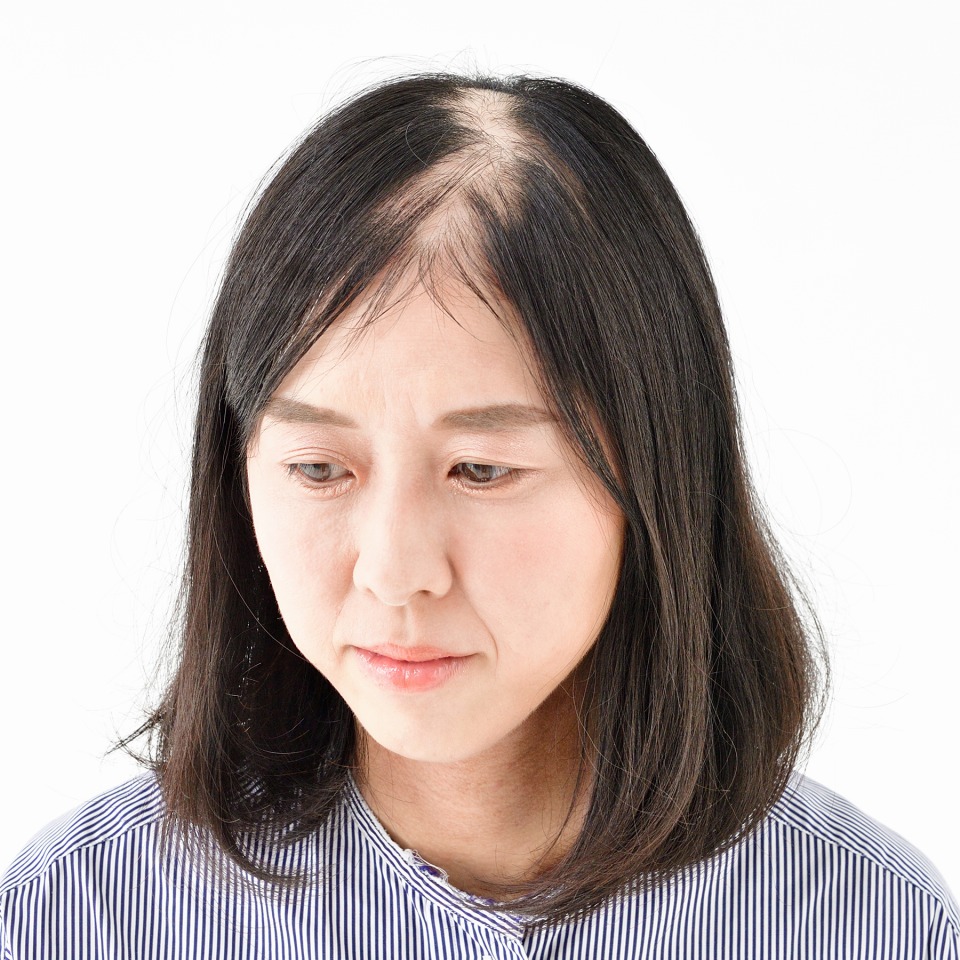 部分ウィッグ 脱毛症・抜毛症・薄毛の方向け · 医療用ウィッグ