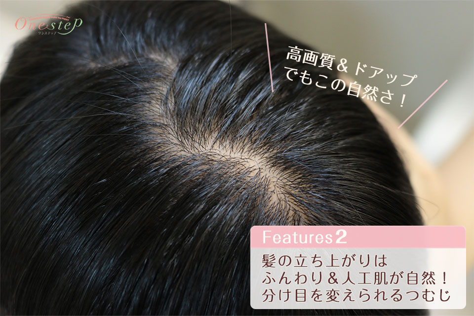 医療用ウィッグシルクナイス・コットンリージェの特長_髪の立ち上がりはふんわり人工肌が自然!分け目を変えられるつむじ