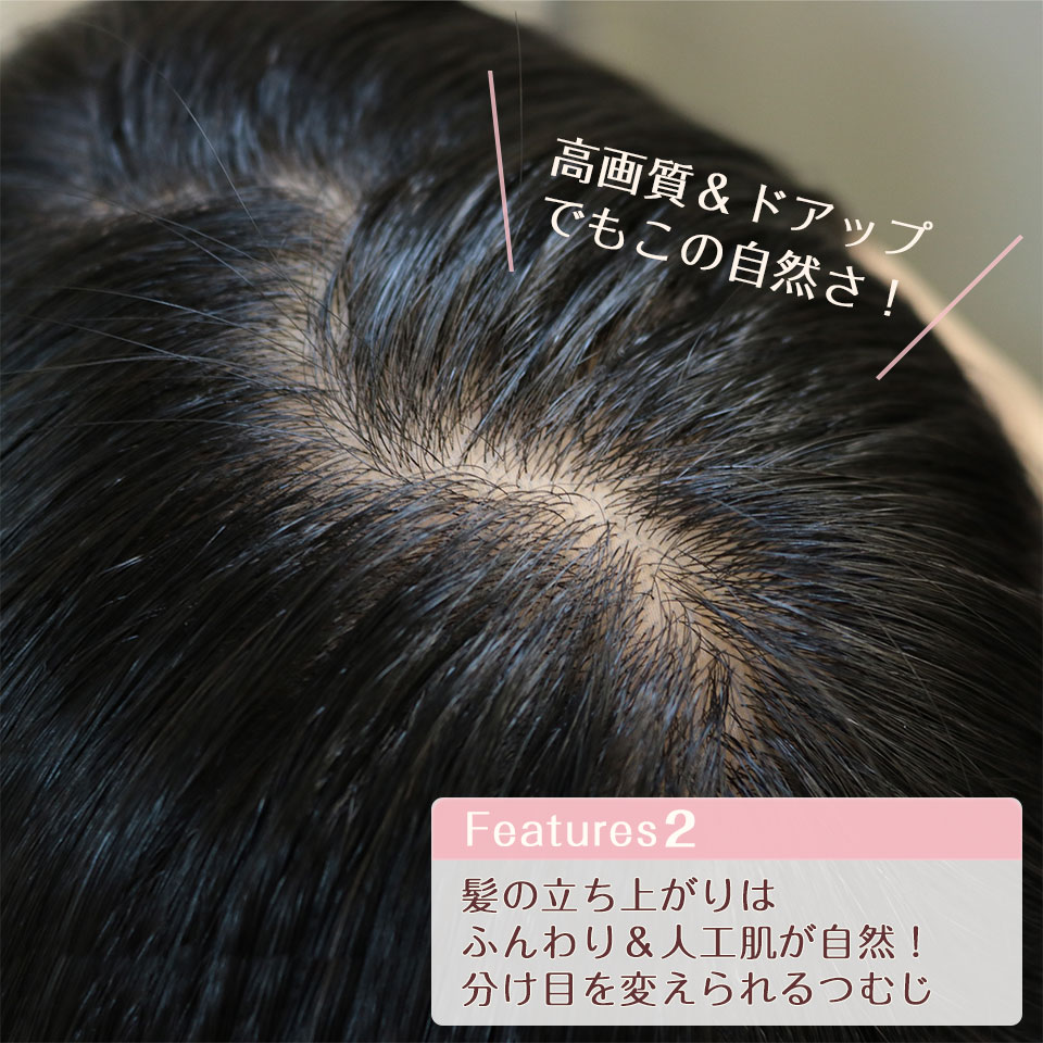 医療用ウィッグシルクナイス・コットンリージェの特長_髪の立ち上がりはふんわり人工肌が自然!分け目を変えられるつむじ_sp