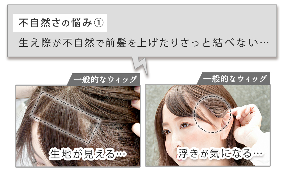 不自然さのお悩み1