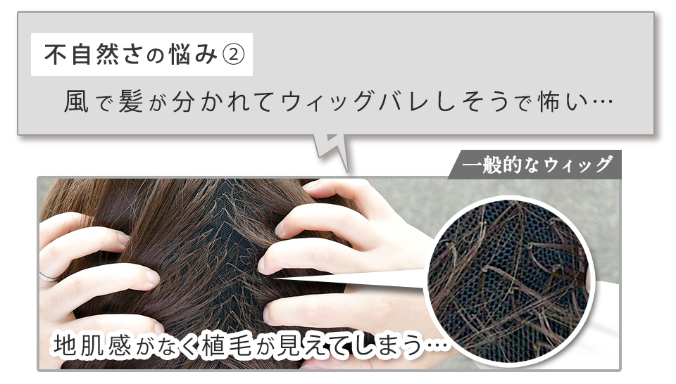 不自然さのお悩み2