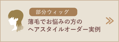 薄毛・円形脱毛症でお悩みの方のウィッグスタイルオーダー実例