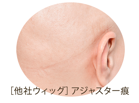 他社ウィッグ:ウィッグのアジャスターゴムの痕